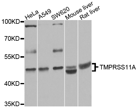 TMPRSS11A Antibody - Western blot analysis of extracts of various cell lines.