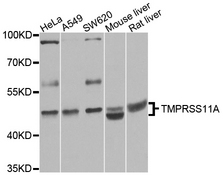 TMPRSS11A Antibody - Western blot analysis of extracts of various cell lines.