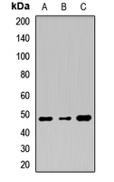 TMPRSS11A Antibody