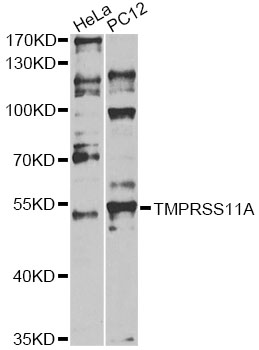 TMPRSS11A Antibody - Western blot analysis of extracts of various cell lines, using TMPRSS11A antibody at 1:1000 dilution. The secondary antibody used was an HRP Goat Anti-Rabbit IgG (H+L) at 1:10000 dilution. Lysates were loaded 25ug per lane and 3% nonfat dry milk in TBST was used for blocking. An ECL Kit was used for detection and the exposure time was 60s.
