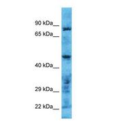 TMPRSS11B Antibody - Western blot of Human HeLa. TMPRSS11B antibody dilution 1.0 ug/ml.  This image was taken for the unconjugated form of this product. Other forms have not been tested.