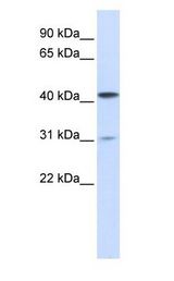 TMPRSS11D / HAT Antibody - TMPRSS11D / HAT antibody Western Blot of 293T cells lysate.  This image was taken for the unconjugated form of this product. Other forms have not been tested.