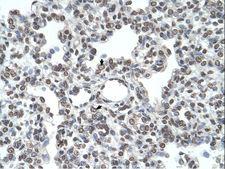 TMPRSS11D / HAT Antibody - TMPRSS11D / HAT antibody Immunohistochemistry of HepG2.  This image was taken for the unconjugated form of this product. Other forms have not been tested.