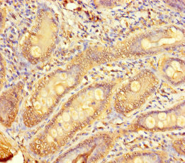 TMPRSS11D / HAT Antibody - Immunohistochemistry of paraffin-embedded human small intestine tissue using TMPRSS11D Antibody at dilution of 1:100