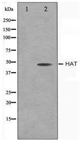 TMPRSS11D / HAT Antibody - Western blot of LOVO cell lysate using HAT Antibody