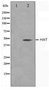 TMPRSS11D / HAT Antibody - Western blot of LOVO cell lysate using HAT Antibody