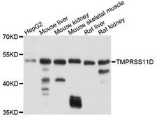 TMPRSS11D / HAT Antibody - Western blot analysis of extracts of various cell lines, using TMPRSS11D antibody at 1:1000 dilution. The secondary antibody used was an HRP Goat Anti-Rabbit IgG (H+L) at 1:10000 dilution. Lysates were loaded 25ug per lane and 3% nonfat dry milk in TBST was used for blocking. An ECL Kit was used for detection and the exposure time was 30s.