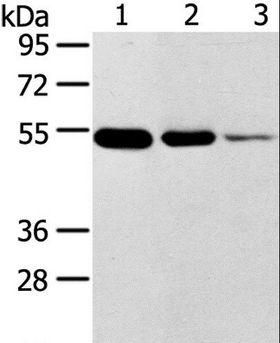 TMPRSS11F Antibody - Western blot analysis of Human thyroid and esophagus cancer, human normal rectum tissue, using TMPRSS11F Polyclonal Antibody at dilution of 1:500.