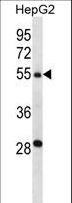 TMPRSS13 / MSP Antibody - TMPRSS13 Antibody western blot of HepG2 cell line lysates (35 ug/lane). The TMPRSS13 antibody detected the TMPRSS13 protein (arrow).