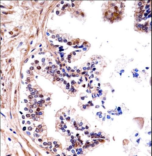 TMPRSS13 / MSP Antibody - TMPRSS13 Antibody immunohistochemistry of formalin-fixed and paraffin-embedded human prostate tissue followed by peroxidase-conjugated secondary antibody and DAB staining.