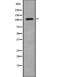 TMPRSS15 / Enterokinase Antibody - Western blot analysis of ENTK using Jurkat whole cells lysates