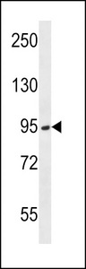 TMPRSS15 / Enterokinase Antibody - PRSS7 Antibody (E979) western blot of Jurkat cell line lysates (35 ug/lane). The PRSS7 antibody detected the PRSS7 protein (arrow).