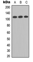 TMPRSS15 / Enterokinase Antibody - Western blot analysis of Enterokinase LC expression in A549 (A); Raw264.7 (B); PC12 (C) whole cell lysates.