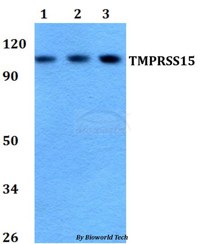 TMPRSS15 / Enterokinase Antibody - Western blot of TMPRSS15 antibody at 1:500 dilution. Lane 1: A549 whole cell lysate. Lane 2: Raw264.7 whole cell lysate. Lane 3: PC12 whole cell lysate.