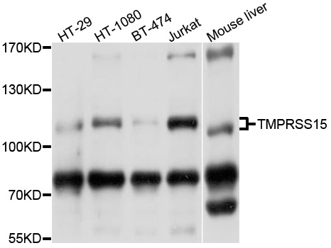 TMPRSS15 / Enterokinase Antibody - Western blot analysis of extracts of various cell lines, using TMPRSS15 antibody at 1:1000 dilution. The secondary antibody used was an HRP Goat Anti-Rabbit IgG (H+L) at 1:10000 dilution. Lysates were loaded 25ug per lane and 3% nonfat dry milk in TBST was used for blocking. An ECL Kit was used for detection and the exposure time was 1s.