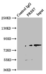 TMPRSS15 / Enterokinase Antibody - Immunoprecipitating PRSS7 in Jurkat whole cell lysate Lane 1: Rabbit control IgG instead of TMPRSS15 Antibody in Jurkat whole cell lysate.For western blotting, a HRP-conjugated Protein G antibody was used as the secondary antibody (1/2000) Lane 2: TMPRSS15 Antibody (8µg) + Jurkat whole cell lysate (500µg) Lane 3: Jurkat whole cell lysate (10µg)