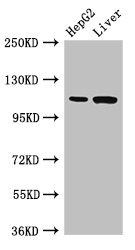 TMPRSS15 / Enterokinase Antibody - Western Blot Positive WB detected in:HepG2 whole cell lysate,Rat liver tissue All Lanes:Tmprss15 antibody at 3µg/ml Secondary Goat polyclonal to rabbit IgG at 1/50000 dilution Predicted band size: 119 KDa Observed band size: 119 KDa