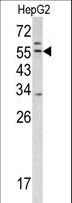 TMPRSS2 / Epitheliasin Antibody - Western blot of TMPRSS2 antibody in HepG2 cell line lysates (35 ug/lane). TMPRSS2 (arrow) was detected using the purified antibody.