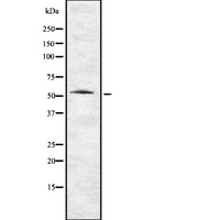 TMPRSS2 / Epitheliasin Antibody - Western blot analysis of TMPRSS2 using NIH-3T3 whole lysates.
