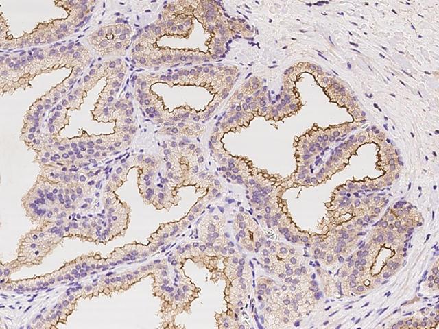 TMPRSS2 / Epitheliasin Antibody - Immunochemical staining of human TMPRSS2 in human prostate with rabbit polyclonal antibody at 1:100 dilution, formalin-fixed paraffin embedded sections.