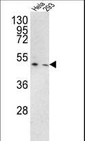 TMPRSS3 Antibody - Western blot of TMPRSS3 Antibody in HeLa, 293 cell line lysates (35 ug/lane). TMPRSS3 (arrow) was detected using the purified antibody.