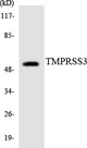 TMPRSS3 Antibody - Western blot analysis of the lysates from HT-29 cells using TMPRSS3 antibody.