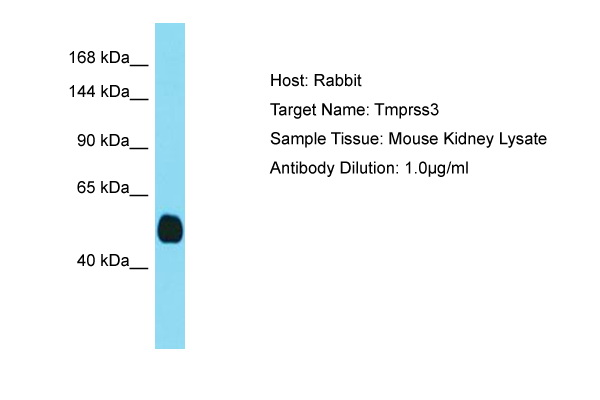 TMPRSS3 Antibody -  This image was taken for the unconjugated form of this product. Other forms have not been tested.