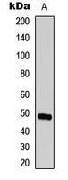 TMPRSS3 Antibody - Western blot analysis of ECHOS1 expression in A431 (A) whole cell lysates.