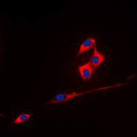 TMPRSS3 Antibody - Immunofluorescent analysis of ECHOS1 staining in A431 cells. Formalin-fixed cells were permeabilized with 0.1% Triton X-100 in TBS for 5-10 minutes and blocked with 3% BSA-PBS for 30 minutes at room temperature. Cells were probed with the primary antibody in 3% BSA-PBS and incubated overnight at 4 deg C in a humidified chamber. Cells were washed with PBST and incubated with a DyLight 594-conjugated secondary antibody (red) in PBS at room temperature in the dark. DAPI was used to stain the cell nuclei (blue).