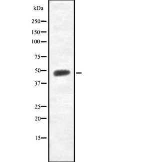 TMPRSS3 Antibody - Western blot analysis of TMPRSS3 using K562 whole cells lysates