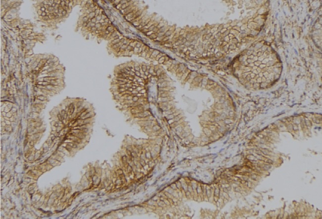 TMPRSS3 Antibody - 1:100 staining mouse colon tissue by IHC-P. The sample was formaldehyde fixed and a heat mediated antigen retrieval step in citrate buffer was performed. The sample was then blocked and incubated with the antibody for 1.5 hours at 22°C. An HRP conjugated goat anti-rabbit antibody was used as the secondary.
