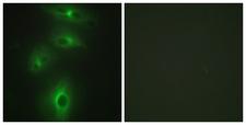 TMPRSS3 Antibody - Peptide - + Immunofluorescence analysis of HeLa cells, using TMPRSS3 antibody.