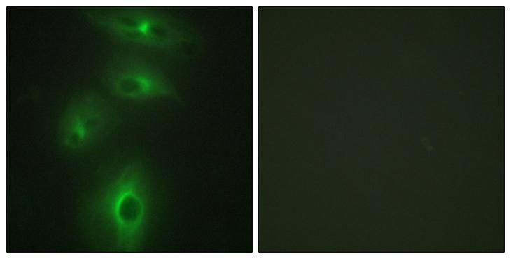 TMPRSS3 Antibody - Peptide - + Immunofluorescence analysis of HeLa cells, using TMPRSS3 antibody.