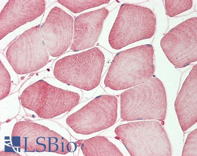 TMPRSS3 Antibody - Human Skeletal Muscle: Formalin-Fixed, Paraffin-Embedded (FFPE).  This image was taken for the unconjugated form of this product. Other forms have not been tested.