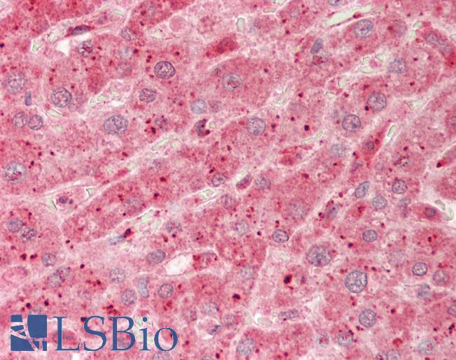 TMPRSS4 Antibody - Human Liver: Formalin-Fixed, Paraffin-Embedded (FFPE).  This image was taken for the unconjugated form of this product. Other forms have not been tested.