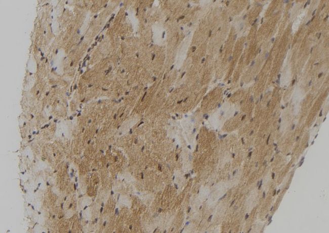 TMPRSS4 Antibody - 1:100 staining mouse heart tissue by IHC-P. The sample was formaldehyde fixed and a heat mediated antigen retrieval step in citrate buffer was performed. The sample was then blocked and incubated with the antibody for 1.5 hours at 22°C. An HRP conjugated goat anti-rabbit antibody was used as the secondary.