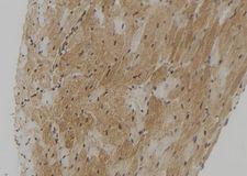 TMPRSS4 Antibody - 1:100 staining mouse heart tissue by IHC-P. The sample was formaldehyde fixed and a heat mediated antigen retrieval step in citrate buffer was performed. The sample was then blocked and incubated with the antibody for 1.5 hours at 22°C. An HRP conjugated goat anti-rabbit antibody was used as the secondary.