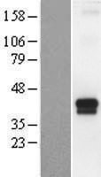 TMPRSS4 Protein - Western validation with an anti-DDK antibody * L: Control HEK293 lysate R: Over-expression lysate