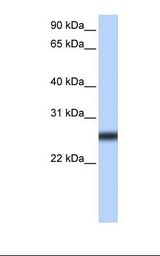 TMPRSS5 Antibody - NTERA2 cell lysate. Antibody concentration: 2.0 ug/ml. Gel concentration: 12%.  This image was taken for the unconjugated form of this product. Other forms have not been tested.