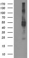 TMPRSS5 Antibody - HEK293T cells were transfected with the pCMV6-ENTRY control (Left lane) or pCMV6-ENTRY TMPRSS5 (Right lane) cDNA for 48 hrs and lysed. Equivalent amounts of cell lysates (5 ug per lane) were separated by SDS-PAGE and immunoblotted with anti-TMPRSS5.