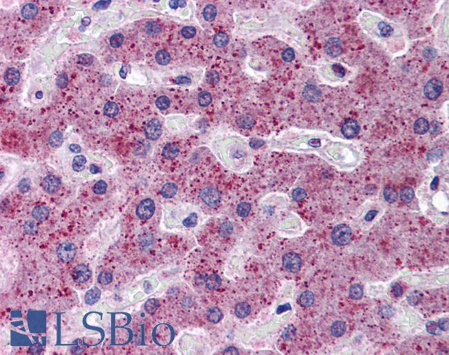 TMPRSS6 Antibody - Anti-TMPRSS6 antibody IHC of human liver. Immunohistochemistry of formalin-fixed, paraffin-embedded tissue after heat-induced antigen retrieval. Antibody concentration 5 ug/ml.  This image was taken for the unconjugated form of this product. Other forms have not been tested.