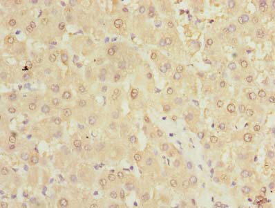 TMPRSS6 Antibody - Immunohistochemistry of paraffin-embedded human liver tissue using antibody at dilution of 1:100.