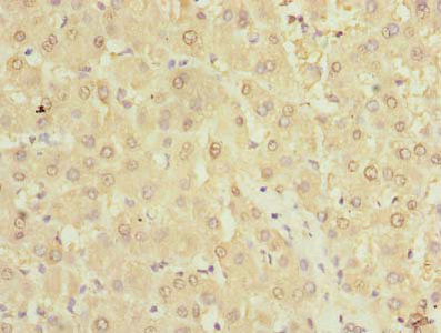 TMPRSS6 Antibody - Immunohistochemistry of paraffin-embedded human liver tissue using TMPRSS6 Antibody at dilution of 1:100