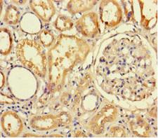 TMPRSS7 Antibody - Immunohistochemistry of paraffin-embedded human kidney tissue using TMPRSS7 Antibody at dilution of 1:100