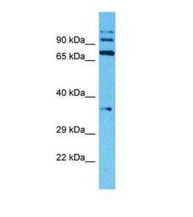 TMPRSS7 Antibody - Western blot of Human Jurkat. TMPRSS7 antibody dilution 1.0 ug/ml.  This image was taken for the unconjugated form of this product. Other forms have not been tested.