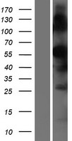 TMPRSS7 Protein - Western validation with an anti-DDK antibody * L: Control HEK293 lysate R: Over-expression lysate