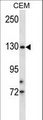 TMPRSS9 Antibody - TMPRSS9 Antibody western blot of CEM cell line lysates (35 ug/lane). The TMPRSS9 antibody detected the TMPRSS9 protein (arrow).