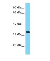 TMPRSS9 Antibody - Western blot of TMPRSS9 Antibody - C-terminal region with human Jurkat cells lysate.  This image was taken for the unconjugated form of this product. Other forms have not been tested.