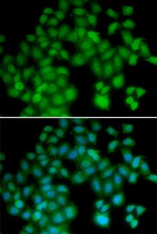 TMSB4X / Thymosin Beta-4 Antibody - Immunofluorescence analysis of HeLa cells.