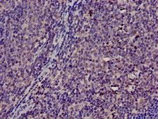 TMSB4X / Thymosin Beta-4 Antibody - Immunohistochemistry image of paraffin-embedded human lymph node tissue at a dilution of 1:100